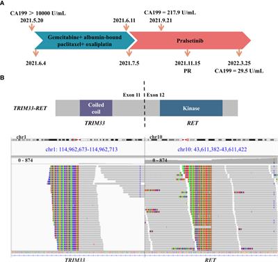 RET rearrangement-positive pancreatic cancer has remarkable response to pralsetinib: a case report